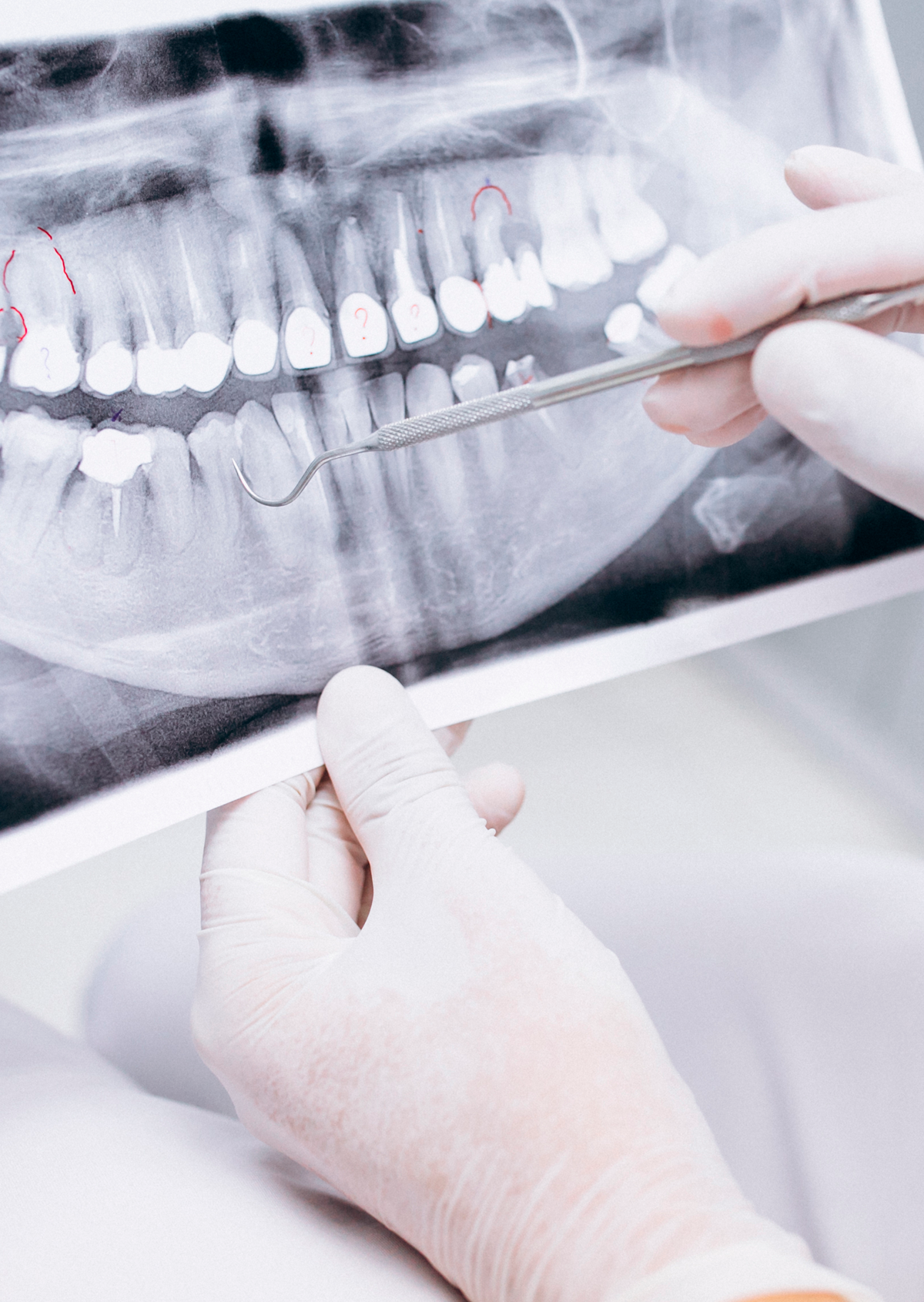endodonciaencordobadentare